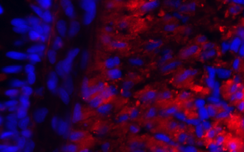 Desmin immunostaining on a cryostat section of the mantle
