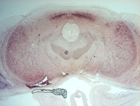 Expression de otx2 dans le cerveau et lobes optiques (CT embryon seiche)