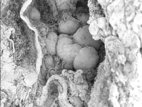 Tubule gonadique d’huître creuse Crassostrea gigas, stade précoce, MEB