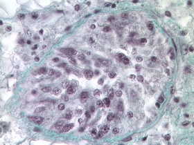 Tubule gonadique d’huître creuse Crassostrea gigas, stade précoce, microscopie photonique.