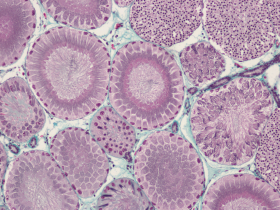 Coupe histologique d’un testicule de roussette, Scyliorhinus canicula, illustrant des stades de la spermatogenèse - P. Sourdaine