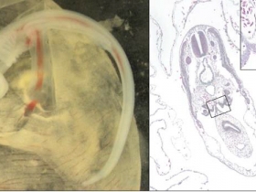 Mise en place des ébauches gonadiques chez l'embryon de petite roussette - A. Gautier