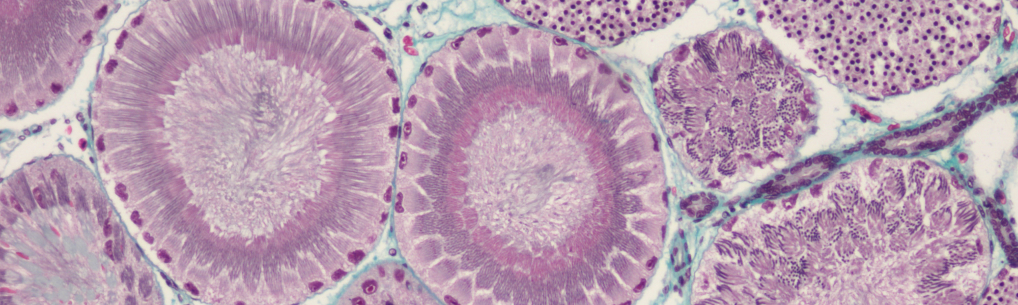 Coupe histologique d’un testicule de roussette, Scyliorhinus canicula, illustrant des stades de la spermatogenèse - P. Sourdaine
