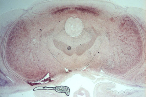 Expression de otx2 dans le cerveau et lobes optiques (CT embryon seiche)