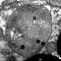 Image MET d'un kleptoplaste chez la limace E. viridis